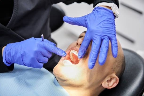Best Emergency Wisdom Tooth Extraction in Roanoke, AL